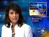 Dr. Bauman Discusses Advances In Hair Restoration With Abc News' Sylvia Perez--Click To Watch