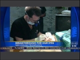 Video: Dr. Bauman On Abc'S Good Morning America Discussing Eyelash Transplants