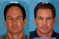 Click For More Of Jim'S Before And After Photos