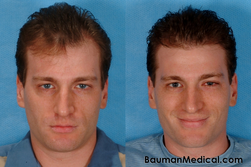 Artistic Hairline Design - -