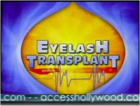 Video: Dr. Bauman'S Eyelash Transplant Procedure On Access Hollywood