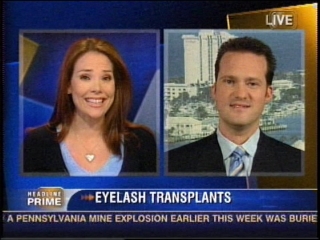 Video: Dr. Bauman Discusses Eyelash Transplantation With Eric Hill On Cnn'S Headling Prime