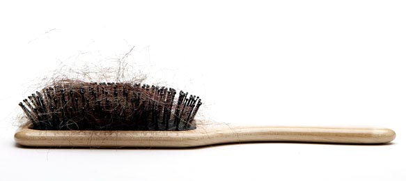 Ny Times: Female Hair Loss - -