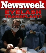 Eyelash Transplants Featured In Newsweek, Visit Www.eyelash-Transplant.com For More Info