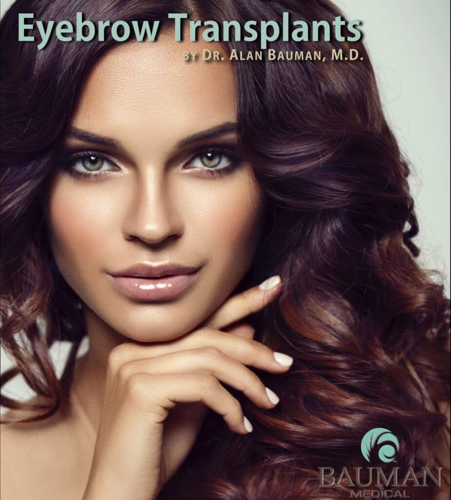 Eyebrow Transplants By Dr. Alan Bauman - Boca Raton, Florida