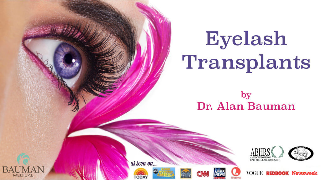 Eyelash-Transplant-And-Implants