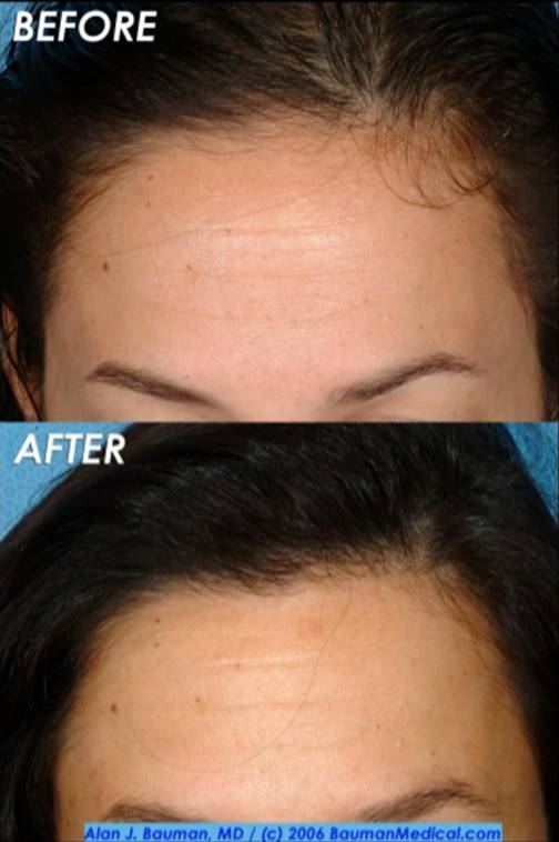 Results Bauman Medical