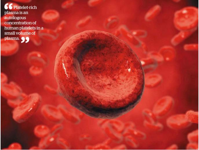 View Platelet Rich Plasma (PRP) Photos on Flickr