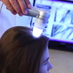 Bauman'S Trichology Program Uses Cutting-Edge Diagnostic Tools To Check For Key Imbalances In The Scalp 