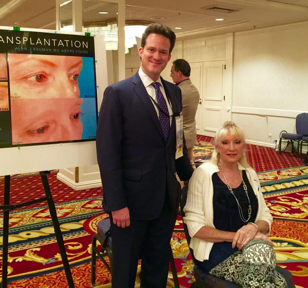 Dr Alan Bauman'S Eyelash Transplant_Trichotillomania_Livepatientviewing Ishrs2015 Chicago