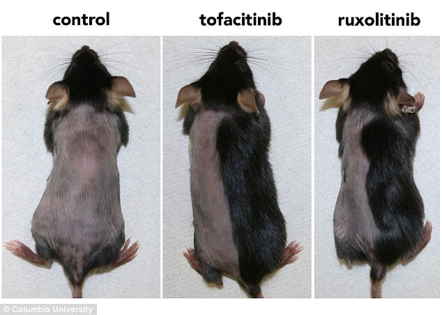 Pharmacologic inhibition of JAK-STAT signaling promotes hair growth