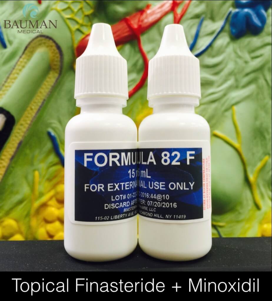 Topical Finasteride