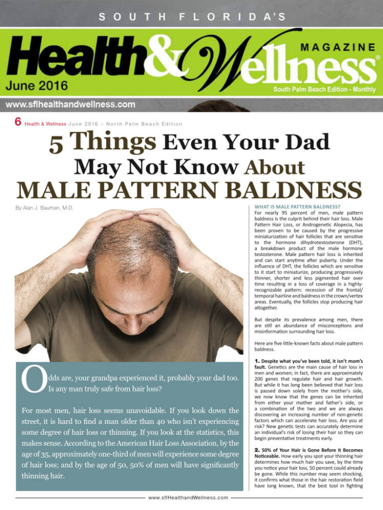 5 Things Even Your Dad Didn’t Know About Male Pattern Baldness