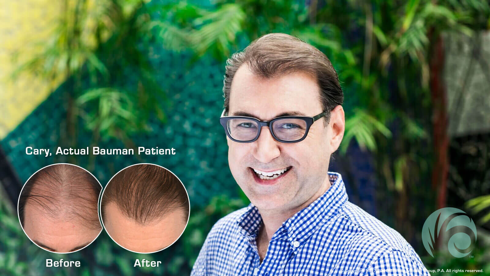 Types of Disease That Cause Hair Loss Manhattan NYC  The Hair Loss Doctors