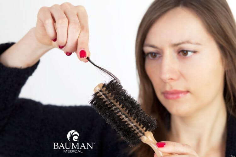 PODCAST: Female Hair Loss Treatments