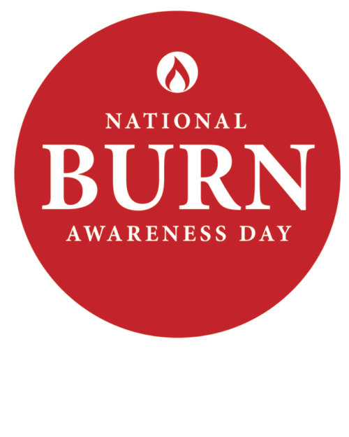 Burn Awareness Day Videos: Scalp Burn Hair Replacement with CNC Hair Prosthesis #BeBurnsAware