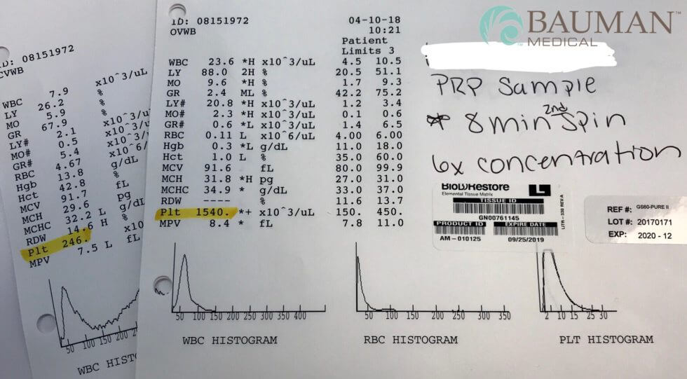 Prp Platelet Concentration Bauman Protocol