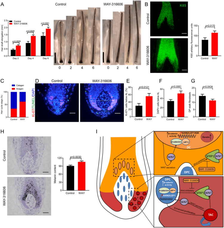 Shampoo containing brittle bones drug WAY-316606 allegedly triggers hair growth via SFRP1 and Wnt pathway