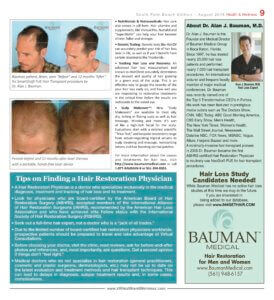 Article: How To Detect And Treat Hair Loss - -