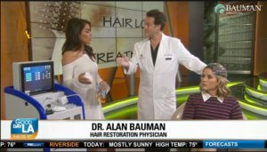 Smartgraft Fue Hair Transplant Dr Alan Bauman Los Angeles