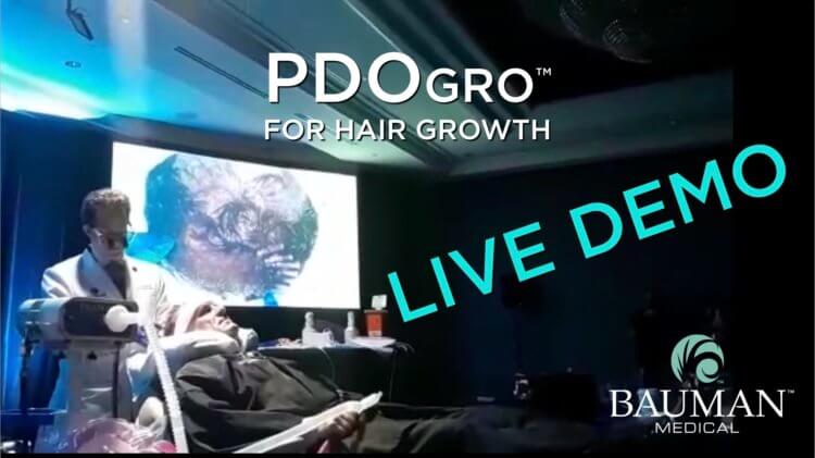 VIDEO: PDOgro PDO Thread Procedure for Hair Growth Demo