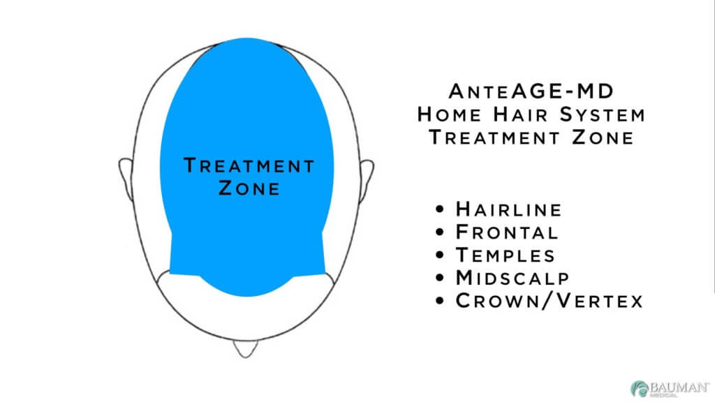 Anteage-Md-Home-Hair-System-Treatment