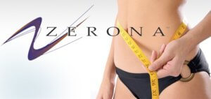 Zerona-Laser-Treatment