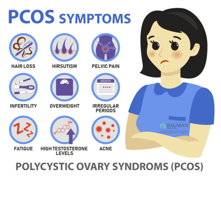 How To Avoid And Treat PCOS Hair Loss Bauman Medical