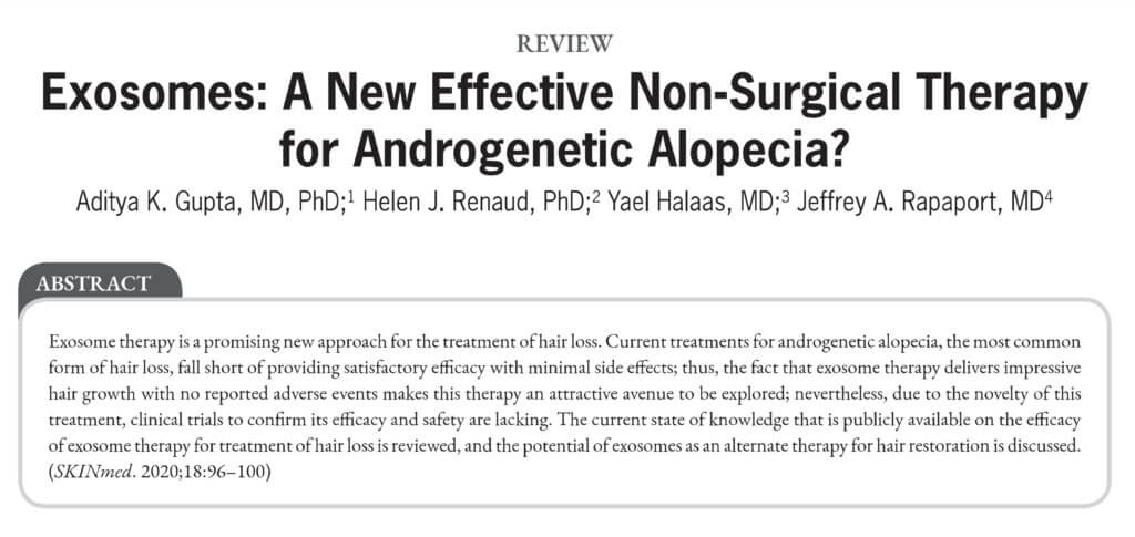 Exosomes New Effective Non-Surgical Hair Loss Therapy - Androgenetic Alopecia