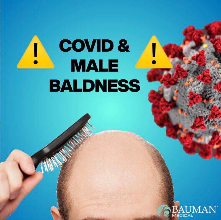 Are Bald Men More Likely To Suffer Severe COVID?