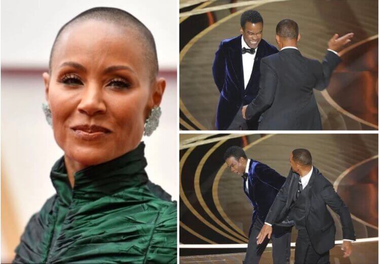 Alopecia, Hair Loss, and the Oscars Slap: What Is ALOPECIA?