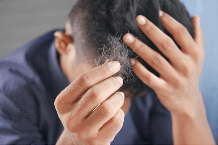 A Quick And Handy Guide To Hair Loss In Teens