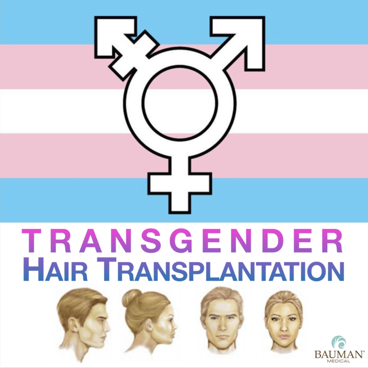 Transgender Hair Transplantation