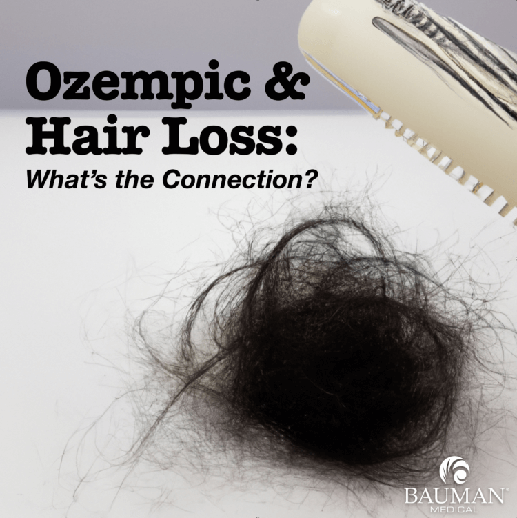 Does Ozempic Cause Hair Loss?