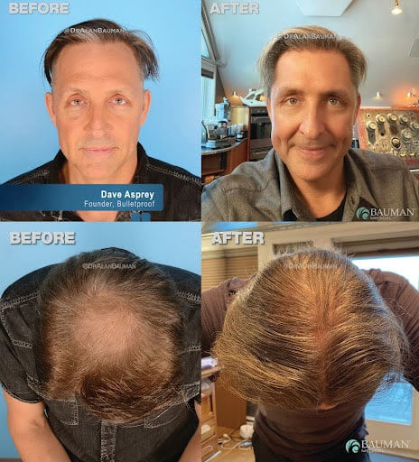 Biohack your way to better hair (exclusive opportunity)