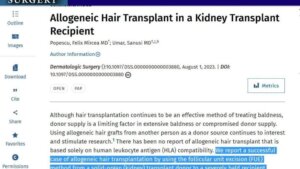 Hair From Strangers? Exploring Allogeneic Hair Transplant Options For An Unlimited Supply Of Hair Allogeneic-Hair-Transplant-Dr-Felix-Hair-Implant-Romania-1024X576